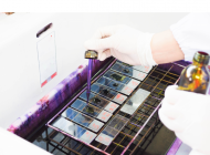 QUY TRÌNH NHUỘM GRAM